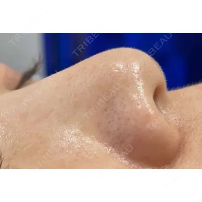 X CLINIC 恵比寿院 辻村 梢医師の症例