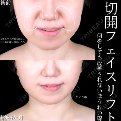 アリエル美容クリニック 大宮院 阪野 一世医師の症例