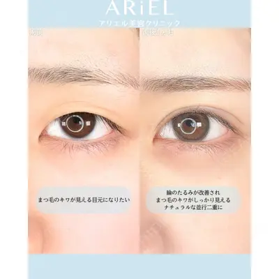 アリエル美容クリニック 横浜院 渡邉 光医師の症例
