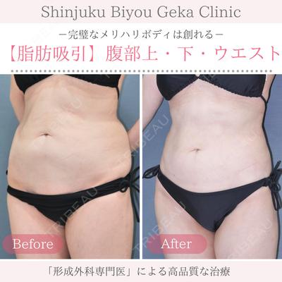 新宿美容外科クリニック 立川院の症例