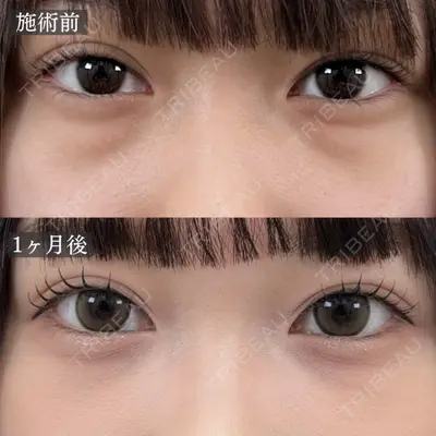 TCB東京中央美容外科 浜松院の症例