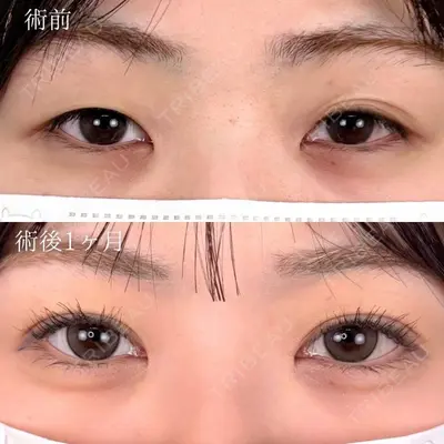 TCB東京中央美容外科 北千住院 奥田 真吾医師の症例