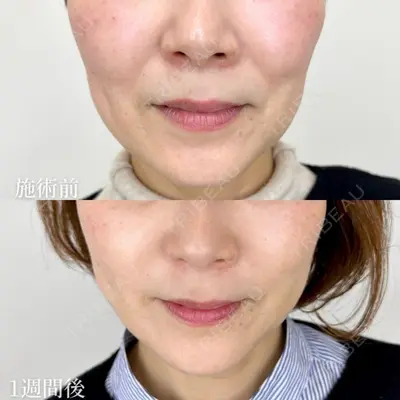 TCB東京中央美容外科 熊本院 垣花 瑠美子医師の症例