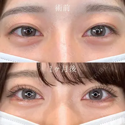 TCB東京中央美容外科 高知院の症例