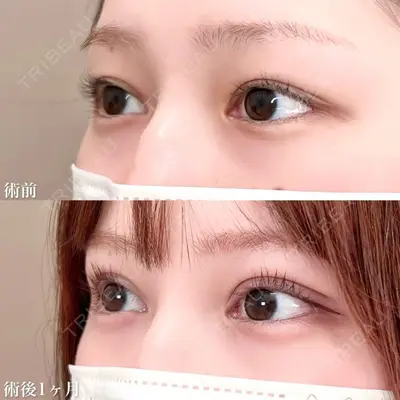 TCB東京中央美容外科 松江院 佐藤 直弥医師の症例