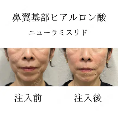 おおたかの森ビューティークリニックの症例