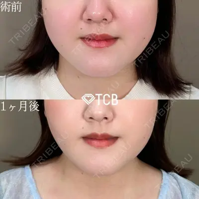 TCB東京中央美容外科 藤沢院 安藤 有沙医師の症例