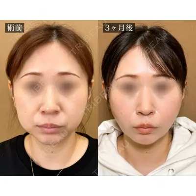 TCB東京中央美容外科 池袋駅前院 岡本 卓也医師の症例