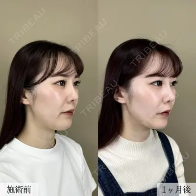 TCB東京中央美容外科 越谷院の症例