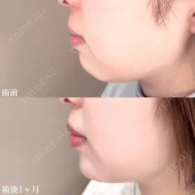 TCB東京中央美容外科 松江院 佐藤 直弥医師の症例