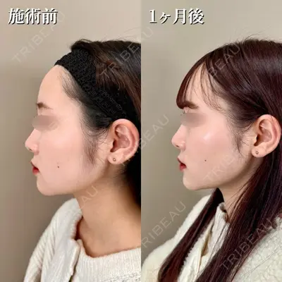 TCB東京中央美容外科 町田院の症例