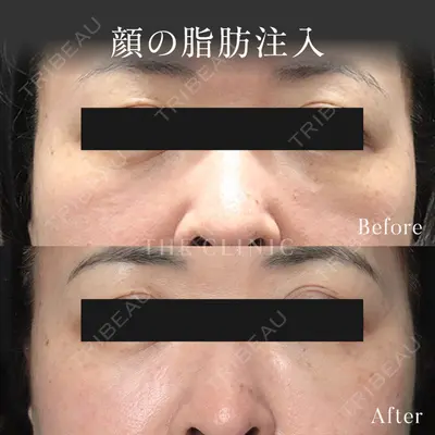 THE CLINIC（ザ・クリニック） 東京院 三塚 健太郎医師の症例