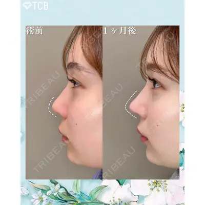 TCB東京中央美容外科 佐賀院の症例