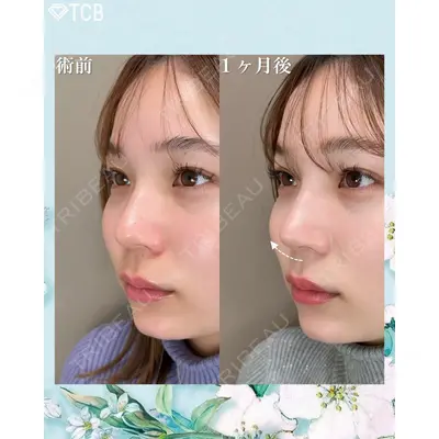 TCB東京中央美容外科 浜松院の症例
