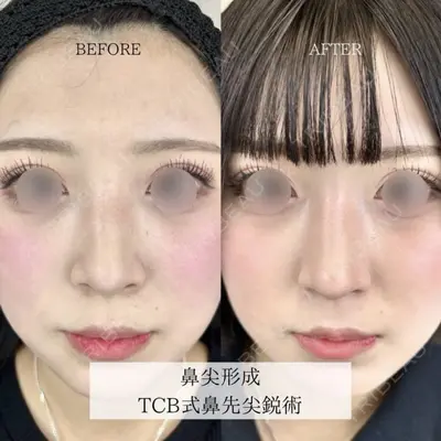 TCB東京中央美容外科 佐賀院の症例