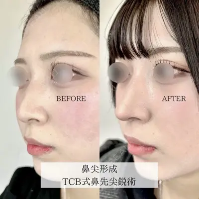 TCB東京中央美容外科 佐賀院の症例