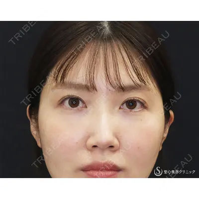 聖心美容クリニック 福岡院 美原 寿之医師の症例