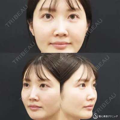 聖心美容クリニック 福岡院 美原 寿之医師の症例