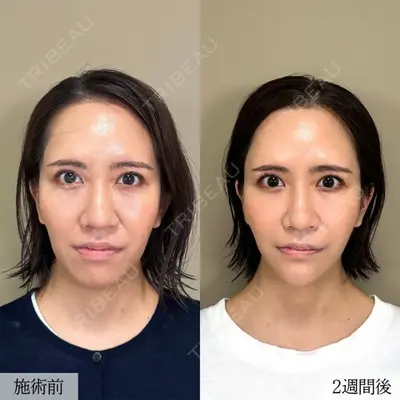 TCB東京中央美容外科 徳島院の症例