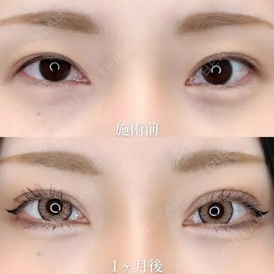 TCB東京中央美容外科 熊本院 垣花 瑠美子医師の症例