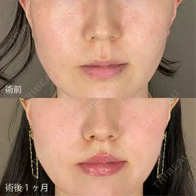 TCB東京中央美容外科 高知院の症例
