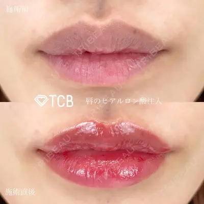 TCB東京中央美容外科 梅田大阪駅前院 寺西 宏王医師の症例