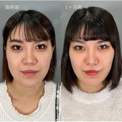 TCB東京中央美容外科 宇都宮院の症例