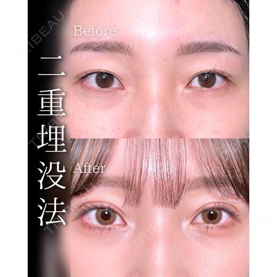 東京シンデレラ美容外科 池袋院 石井 達也医師の症例