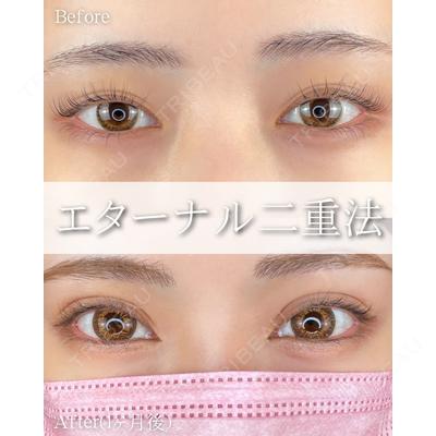 ルラ美容クリニック 大阪本院 平田 一記医師の症例