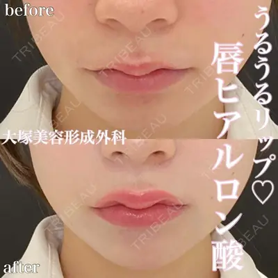 大塚美容形成外科 銀座本院 石井秀典医師の症例