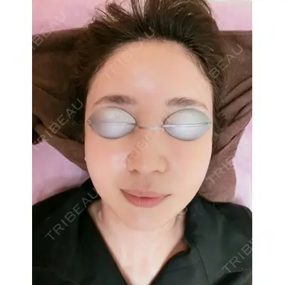 やさしい美容皮膚科・皮フ科　秋葉原院の症例