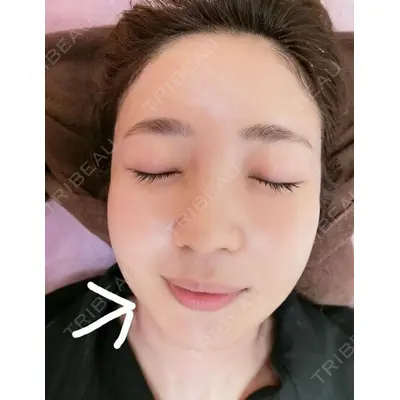 やさしい美容皮膚科・皮フ科　秋葉原院の症例