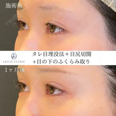 LOUIS CLINIC 二子玉川院【ルイクリニック】 小松 塁医師の症例