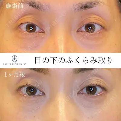 LOUIS CLINIC 二子玉川院【ルイクリニック】 小松 塁医師の症例