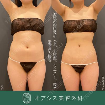 オアシス美容外科 遠藤 剛史医師の症例