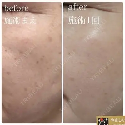 やさしい美容皮膚科・皮フ科　秋葉原院の症例