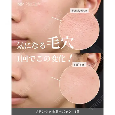 Otus Clinic 【オータスクリニック】 中 徳太郎医師の症例