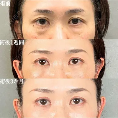 アリエル美容クリニック 大宮院 鈴木　桂介医師の症例
