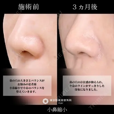 東京形成美容外科 銀座院 弓削田　浩主医師の症例