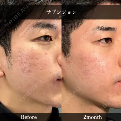 PRISM Beauty Clinic 新宿院 畑山 知輝医師の症例