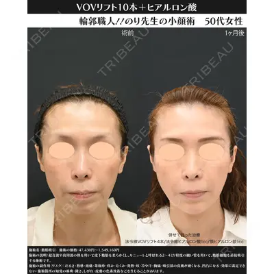 湘南美容クリニック 川崎院の症例