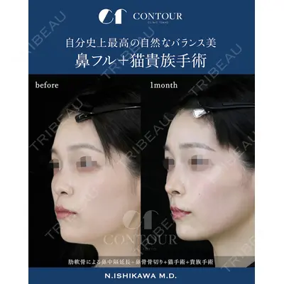 コントアクリニック 東京 石川 菜緒医師の症例