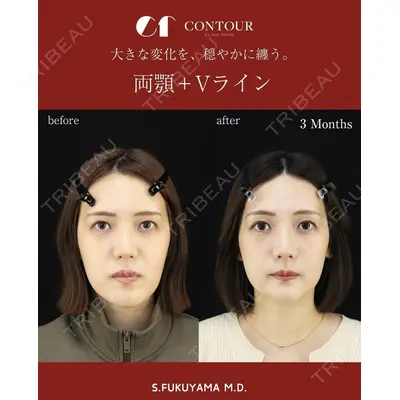 コントアクリニック 東京 福山 漱辰医師の症例