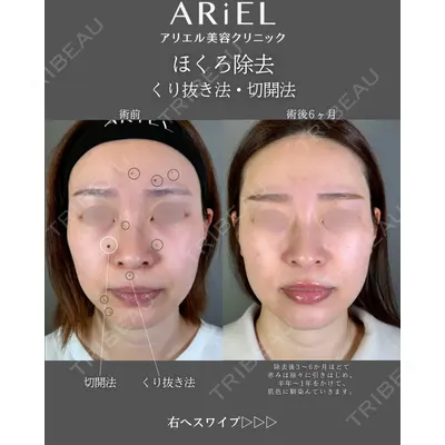 アリエル美容クリニック 郡山院 安齋 誠基医師の症例