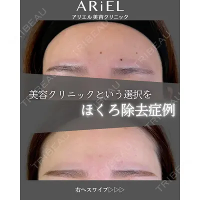 アリエル美容クリニック 郡山院 安齋 誠基医師の症例