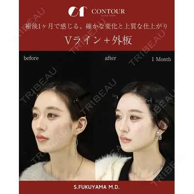 コントアクリニック 東京 福山 漱辰医師の症例