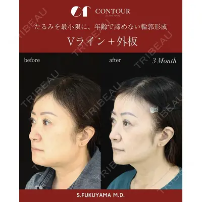 コントアクリニック 東京 福山 漱辰医師の症例