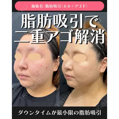 湘南美容クリニック 川崎院の症例