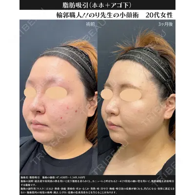 湘南美容クリニック 川崎院の症例