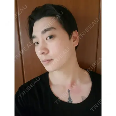 DA美容外科 LEE SANG WOO医師の症例